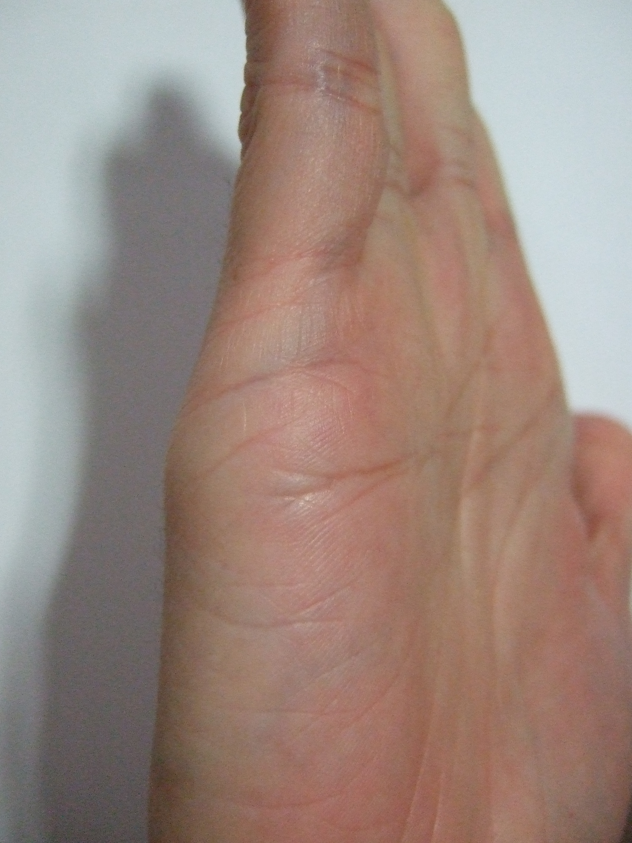 right - side.JPG